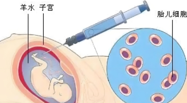 高龄女性想要试管哪些检查必须做?还需要做哪些准备工作?